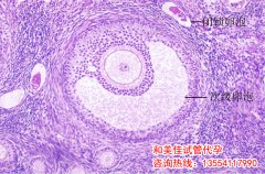 人工授精成功率与哪些因素有关